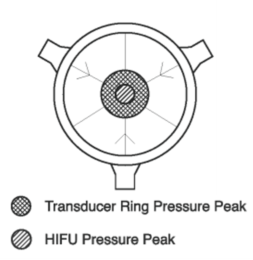 A top view of the sonoreactor design