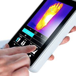 Saving lives through early foot ulcer detection