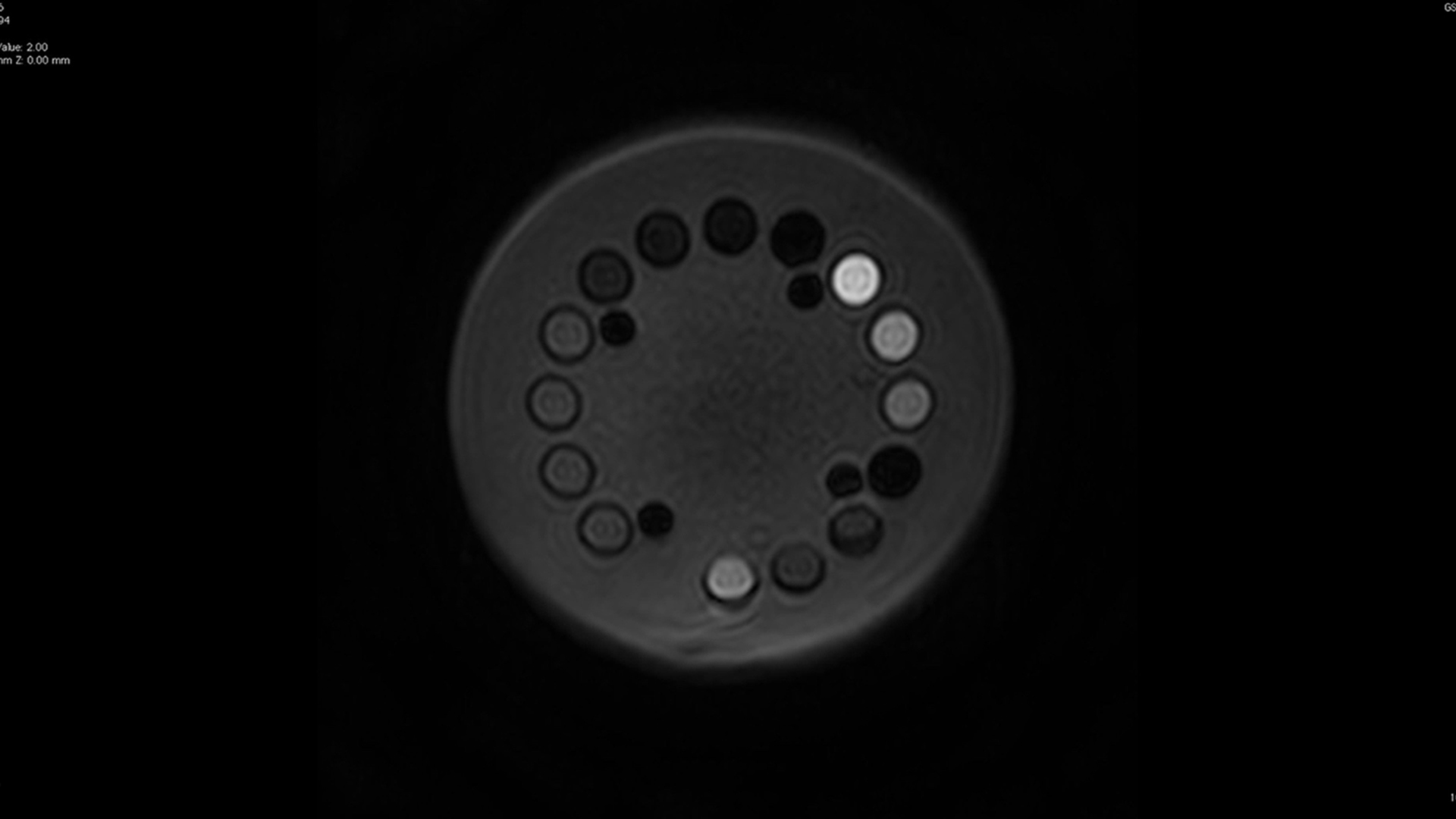 Standardising MRI phantoms for quantitative image comparison NPL