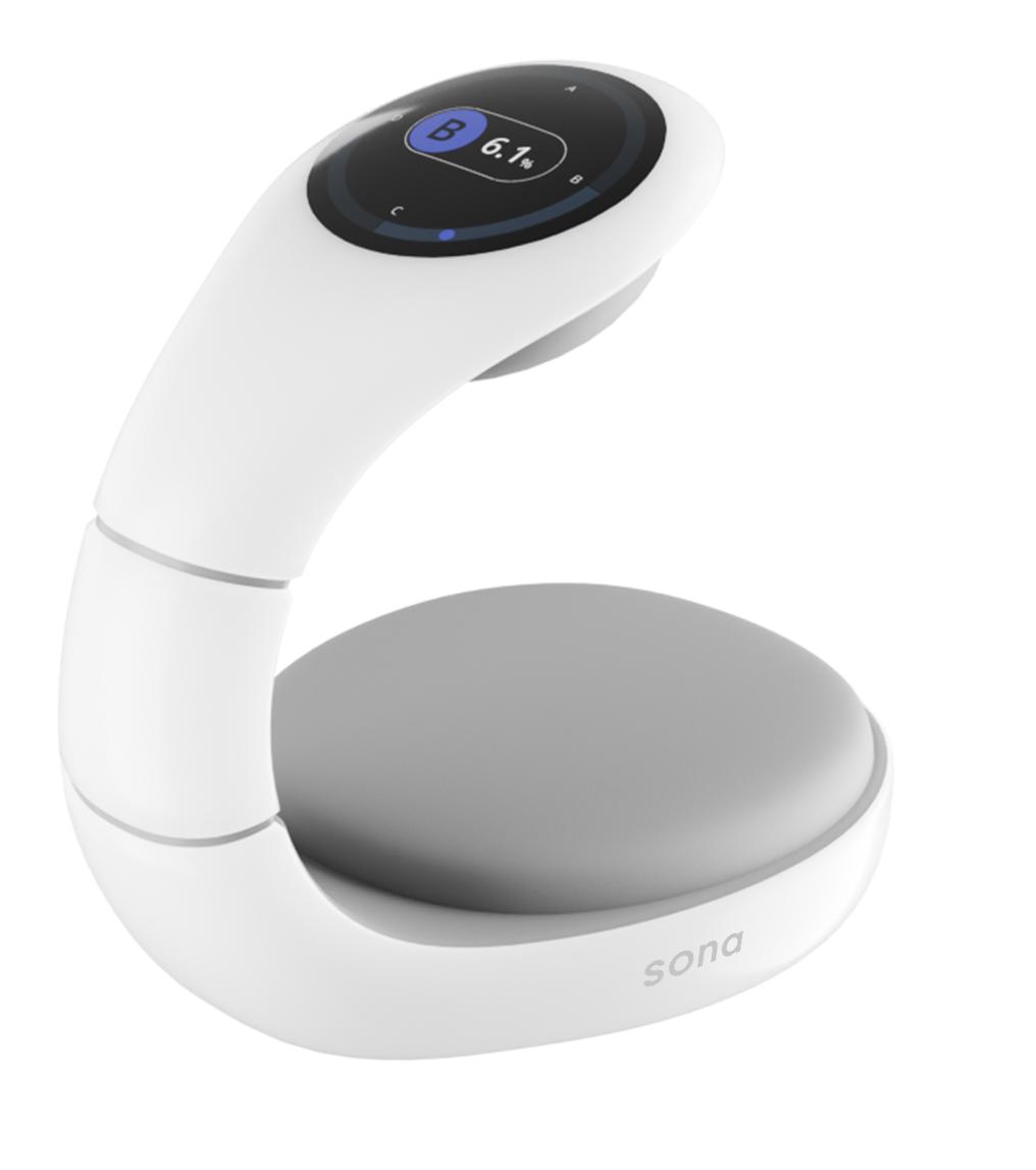 White and grey Sona breast scanner with a curved design and digital display screen showing breast scan data.​